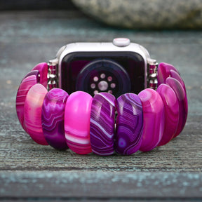 Pulseira de Apple Watch de Agata Orquídea Radiante